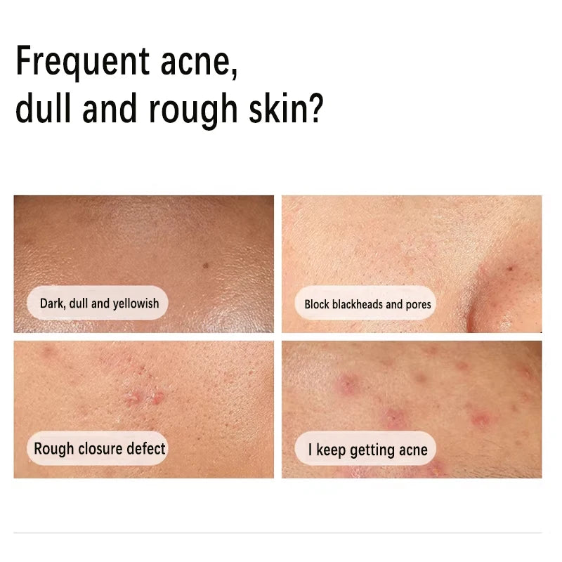 ClearSkin Niacinamide Oil Control Serum